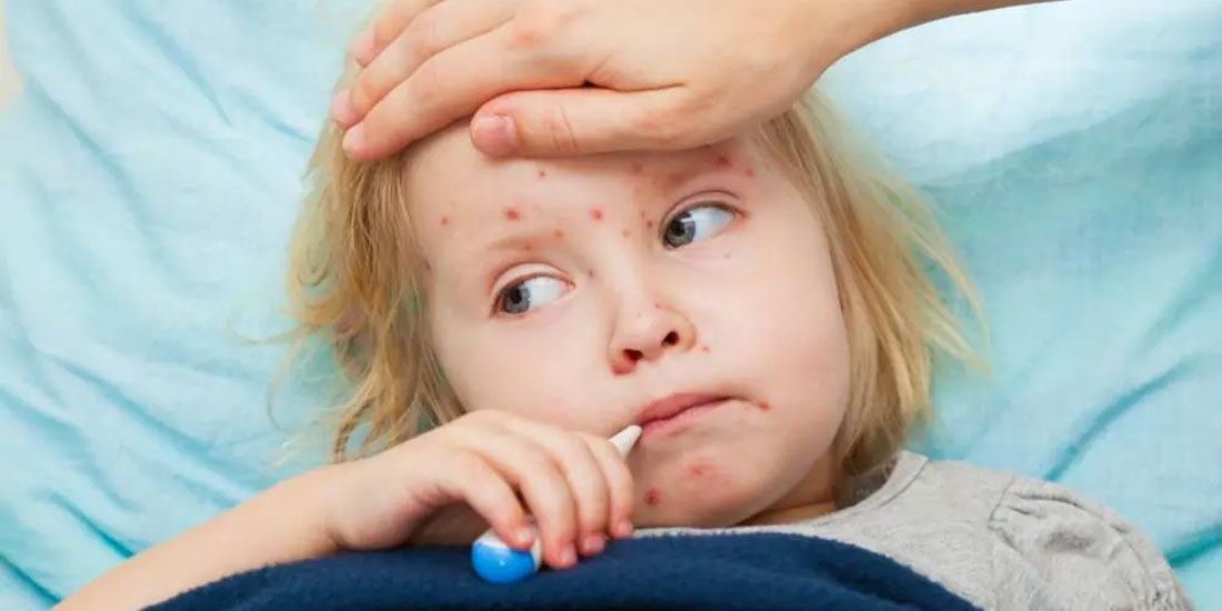 Συναγερμό προκαλεί στη UNICEF η αναζωπύρωση των επιδημιών ιλαράς σε παγκόσμιο επίπεδο
