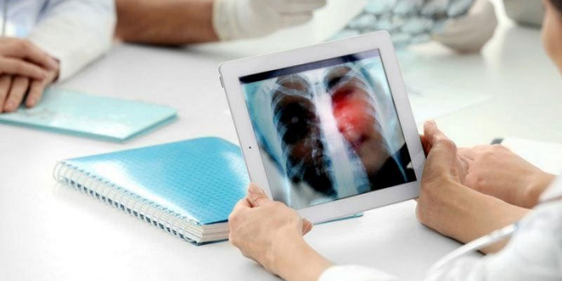 Απόντες οι Χειρουργοί Ογκολόγοι από τη συνεδρίαση του Εθνικού Ινστιτούτου Νεοπλασιών
