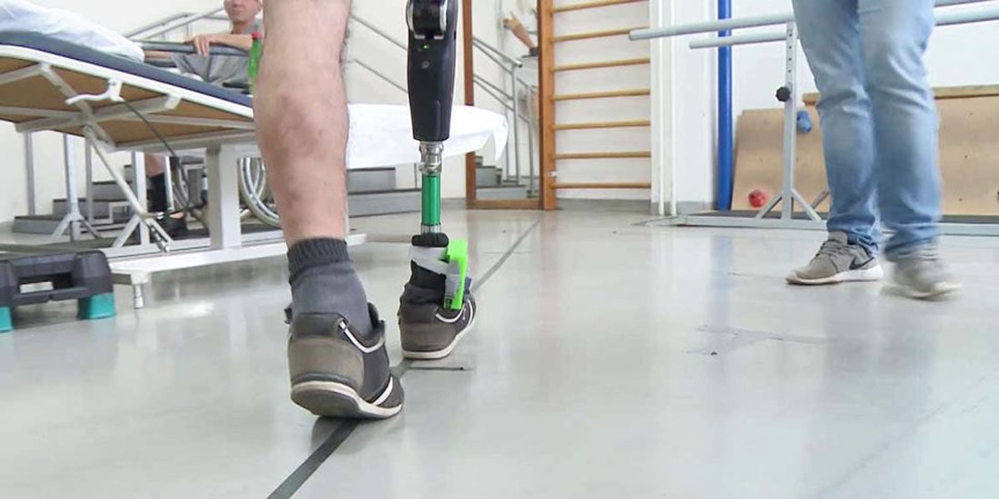 Πρόσθετο πόδι συνδεδεμένο με νεύρα γίνεται αντιληπτό ως μέρος του σώματος