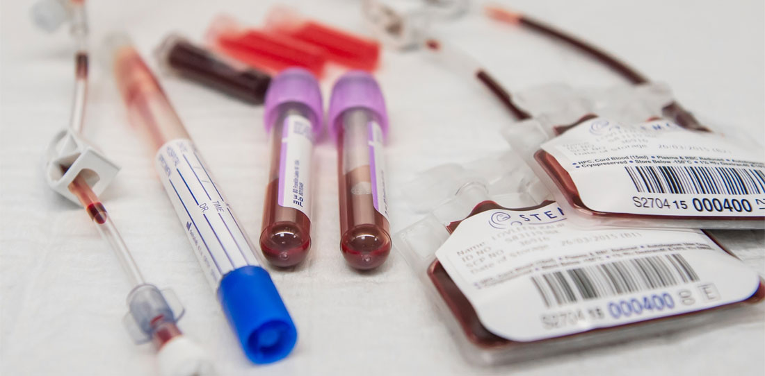 Μέτρα προστασίας δοτών και υποψήφιων ληπτών αιμοποιητικών κυττάρων και μυελού των οστών κατά τη διάρκεια της πανδημίας COVID-19