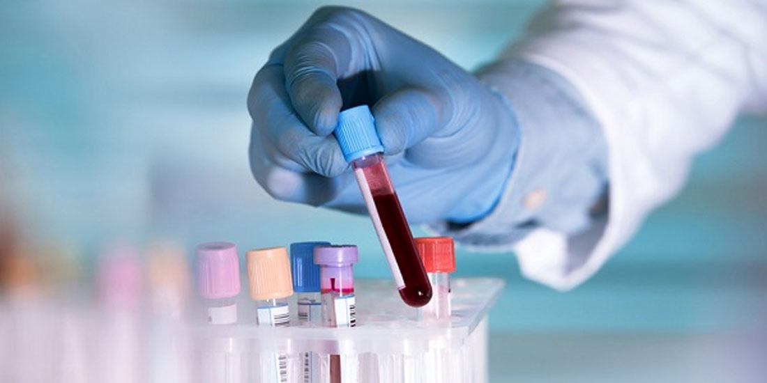 Ενθαρρυντικά τα αποτελέσματα του νέου απλού αιματολογικού τεστ DNA CancerSEEK 