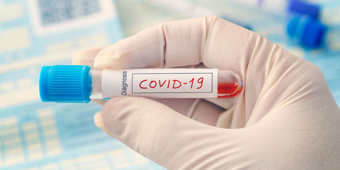 Τα αναπάντητα ερωτήματα για την ανοσία μετά από λοίμωξη COVID-19