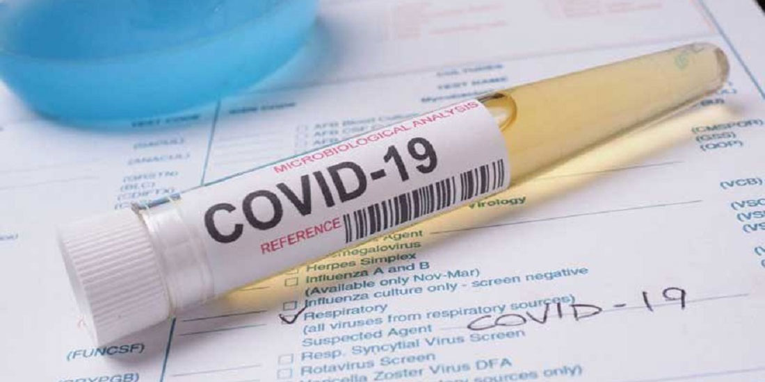 Πώς η μετάδοση της COVID-19 περιορίζεται σημαντικά με μη-φαρμακευτικές παρεμβάσεις 