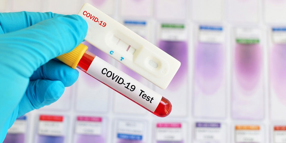 COVID-19: Δυνατότητες και περιορισμοί των rapid test 