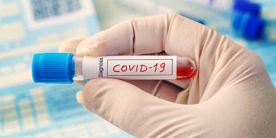 Οι άνθρωποι με ομάδα αίματος Ο έχουν τον μικρότερο κίνδυνο λοίμωξης Covid-19