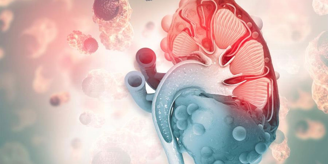 Θεραπεία και νεότερα επιστημονικά δεδομένα για τον κληρονομικό καρκίνο του νεφρού VHL και τον καρκίνο του νεφρού