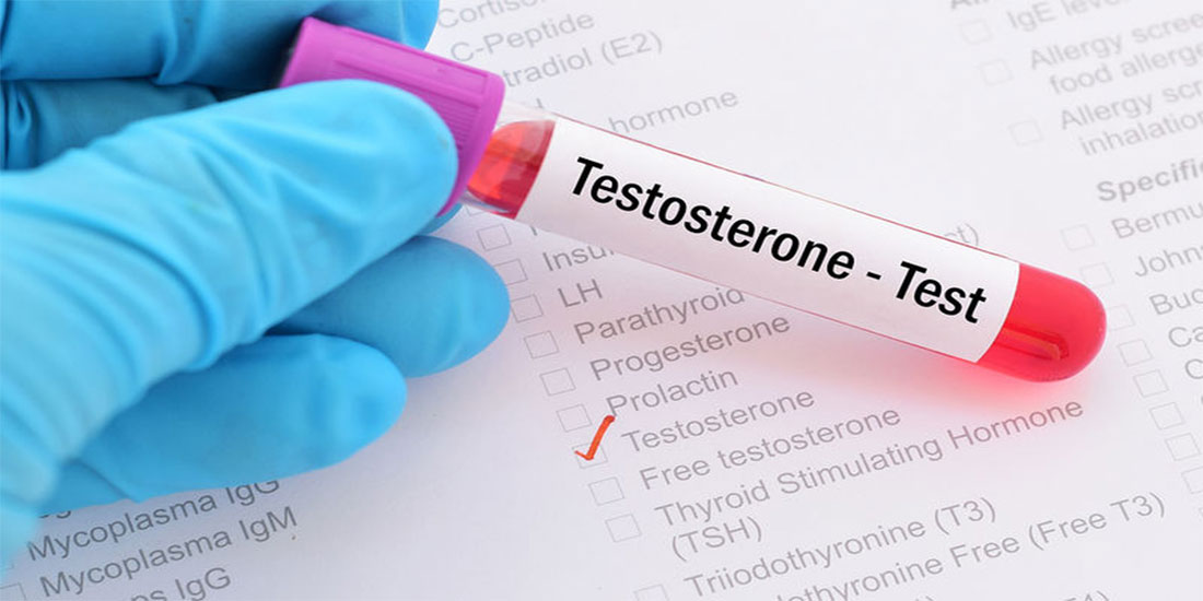 Η πολλή τεστοστερόνη οδηγεί τους άνδρες σε πολλές σεξουαλικές συντρόφους