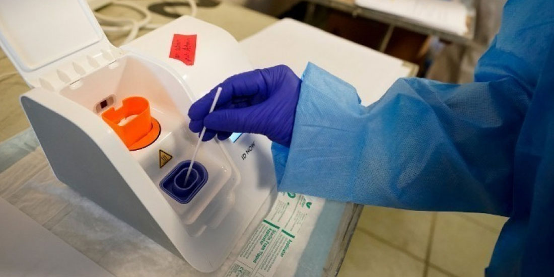 Το νέο τεστ ELISA ανιχνεύει τα αντισώματα του κορονοϊού στα ούρα και όχι στο αίμα