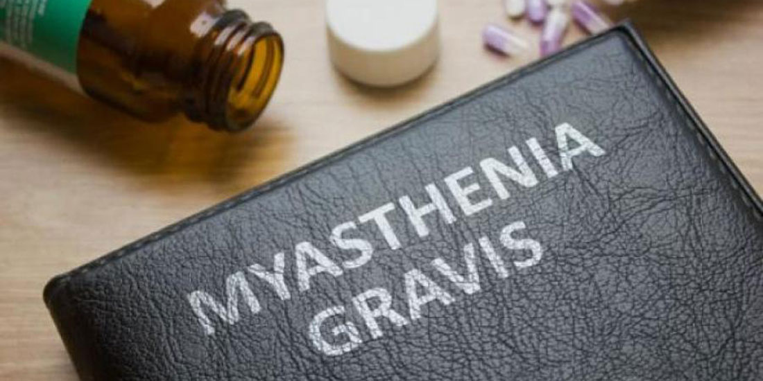 Νεότερες θεραπείες για τη μη ιάσιμη Myasthenia Gravis