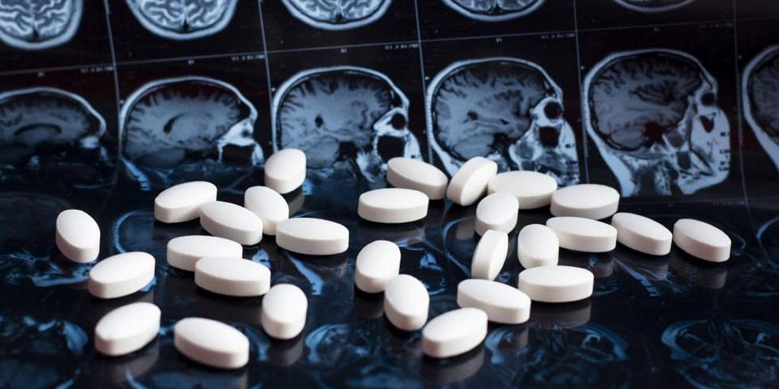 Πειραματικό φάρμακο δείχνει ελπίδες για επιβράδυνση της νόσου Αλτσχάιμερ