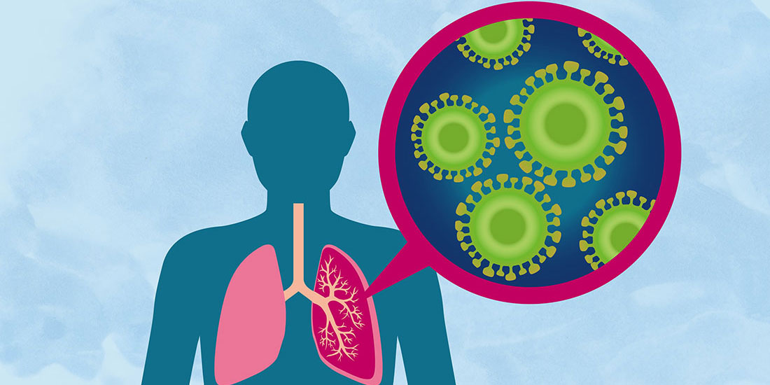 Επιδημιολογική έκθεση ΕΟΔΥ για τις ιογενείς λοιμώξεις του αναπνευστικού