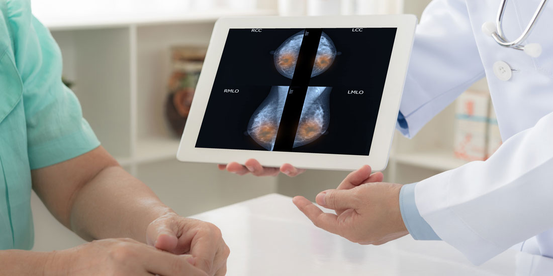 Oncotype DX: Διαγνωστική εξέταση για εξατομίκευση της θεραπείας ασθενών με πρώιμο καρκίνο του μαστού
