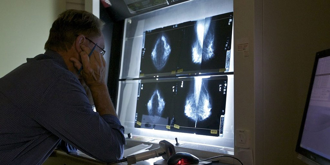 Βρετανία: Μεγαλύτερες διαστάσεις φαίνεται να λαμβάνει το σκάνδαλο προσυμπτωματικού ελέγχου για τον καρκίνο του μαστού 
