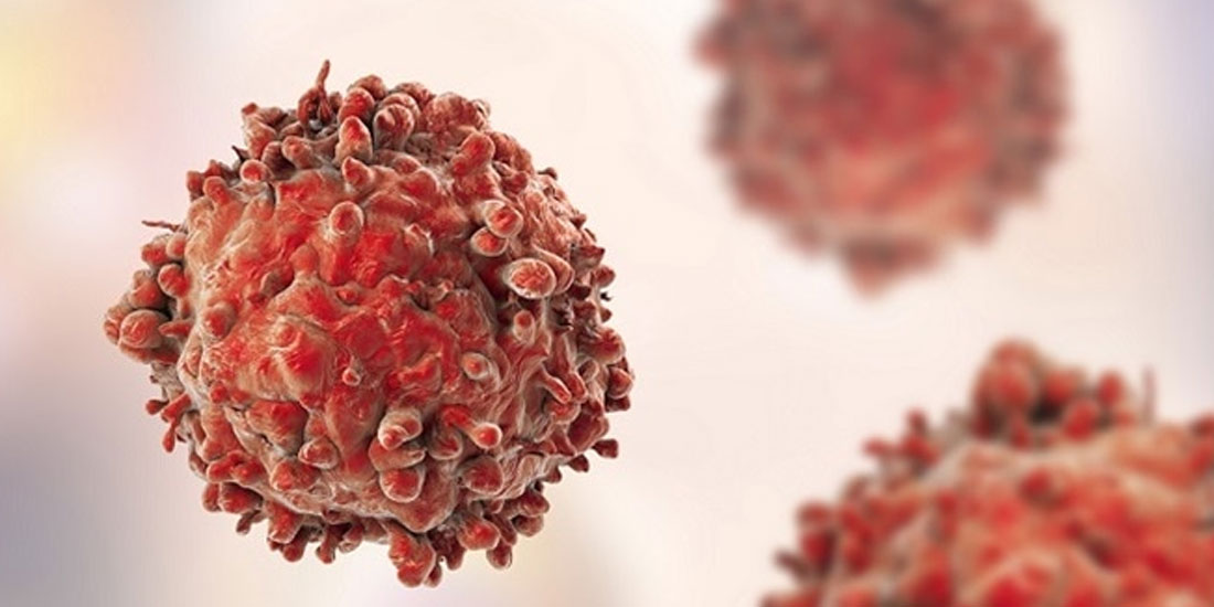 «Γνωρίζουμε τον Αιματολογικό Καρκίνο»: Επιστημονική Ενημερωτική Ημερίδα της ΕΛΛΟΚ