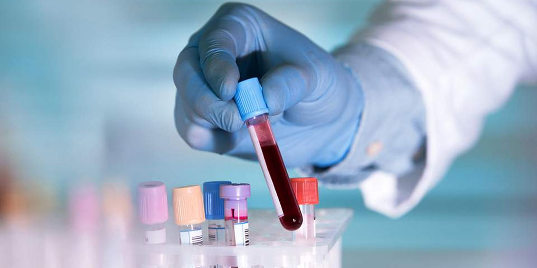 Νέο τεστ αίματος προβλέπει την πρόγνωση της Πολλαπλής Σκλήρυνσης